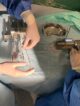 brachyterapia ze stałymi implantami, brachyterapia